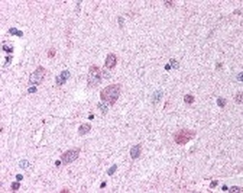 PAEL Receptor Antibody