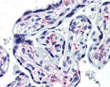 IL1R1 Antibody [40101]