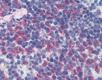 CD69 Antibody (FITC)