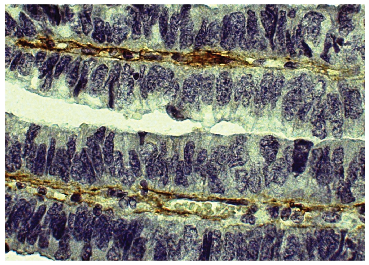 Type V Collagen Antibody