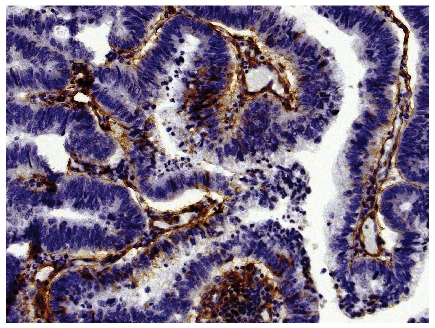 Type IV Collagen Antibody