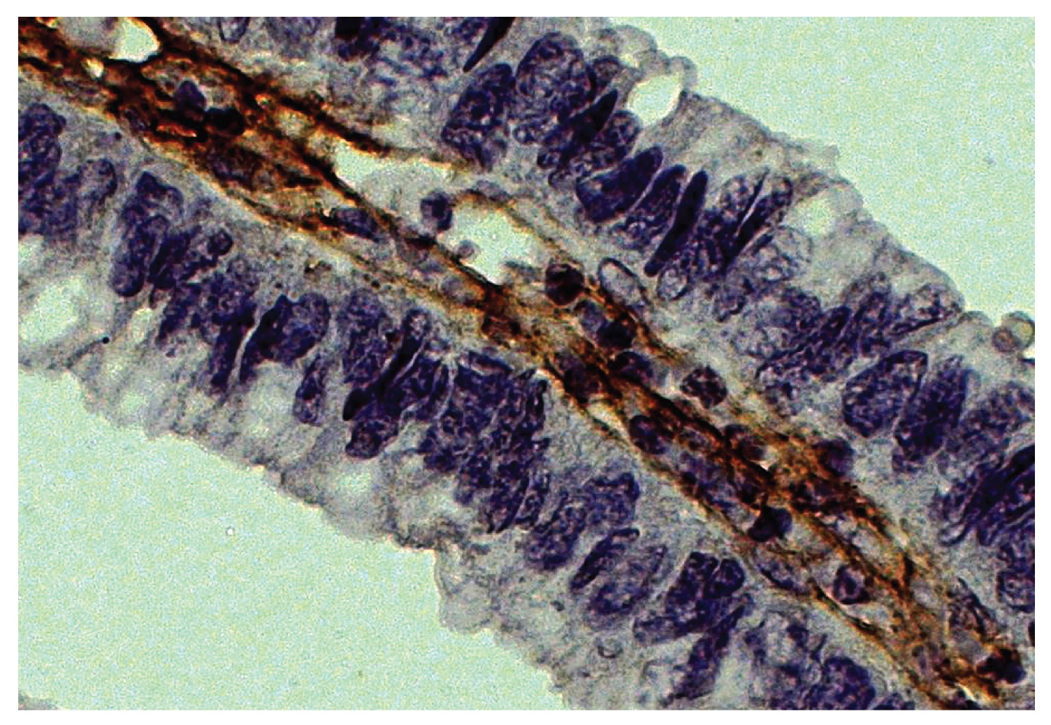 Type III Collagen Antibody