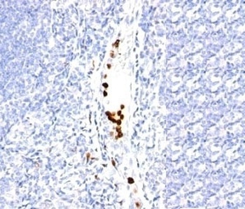 Granulocyte Antibody [SPM250]