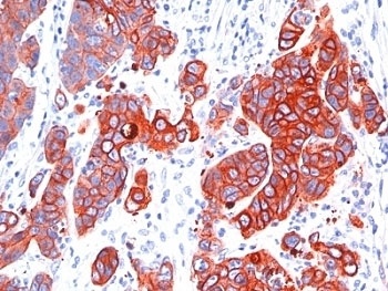 Multi-Cytokeratin Antibody [SPM583]