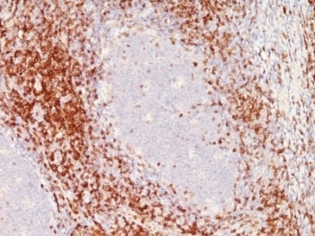 CD6 Antibody [SPM547]