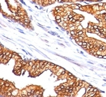 Ornithine Decarboxylase Antibody [SPM565]