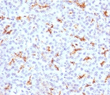 CFTR Antibody [CFTR1-1]