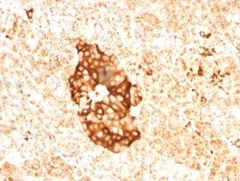 Ferritin (light china specific) Antibody [FTLC1-1]