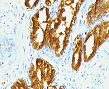 ACPP Antibody