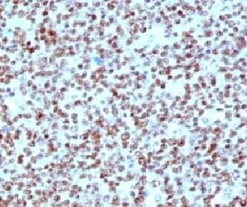 NCL Antibody