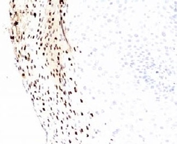 HPV-16 L1 Antibody [MCAPL1]