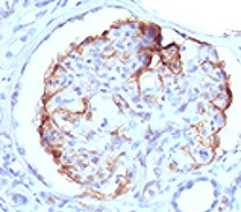 WT1 Antibody