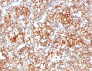 BSG Antibody