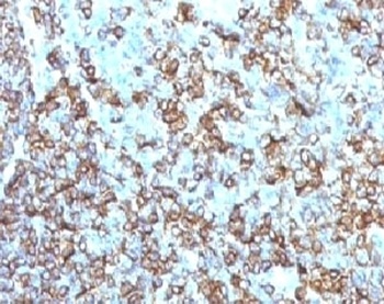 HLA-DRB1 Antibody