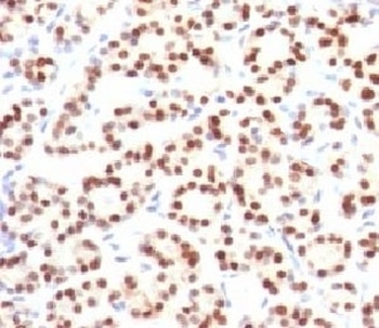 NKX2-1 Antibody