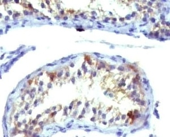 Prolactin Receptor Antibody [ERSV8-1]