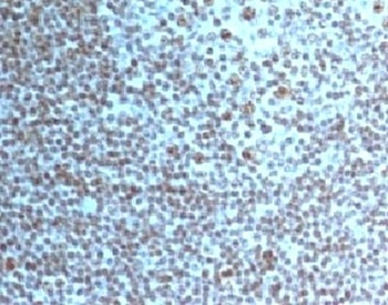 Nucleoli Marker Antibody [NCM102-1]