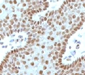 MYC Antibody