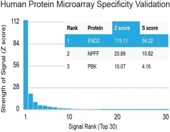 Neuron Specific Enolase Antibody [ENO2/1462]