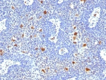HPV-16 Antibody [HPV16/1296]