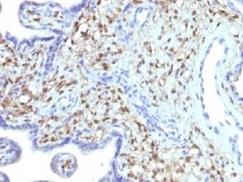 S100A4 Antibody