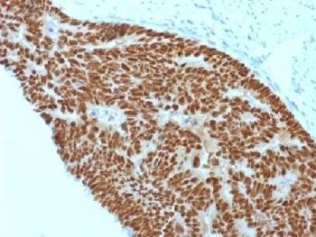 CDX2 Antibody [CDX2/1690]