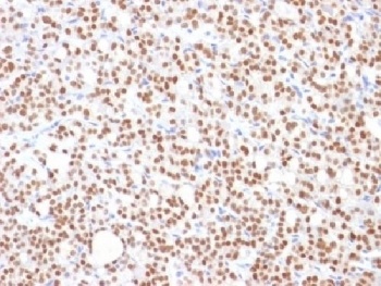 PAX8 Antibody [PAX8/1492]