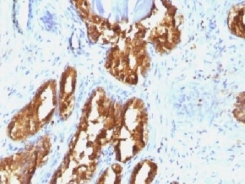 PSAP Antibody [ACCP/1338]