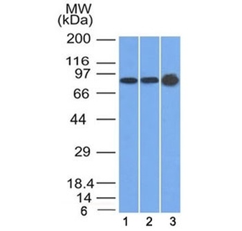 Plakophilin 1 Antibody [10B2]