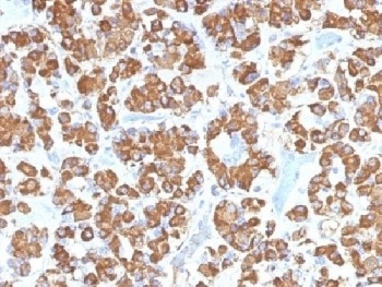Growth Hormone Antibody [GH/1450]