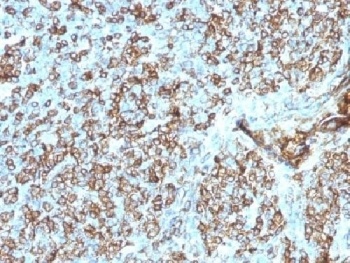 HLA-DP + HLA-DQ + HLA-DR Antibody [CR3/43]