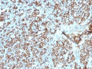 HLA-DPB1, HLA-DQA1 Antibody