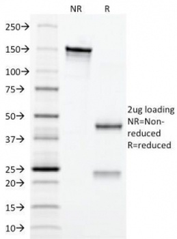 Erythropoietin Antibody [EPO/1367]