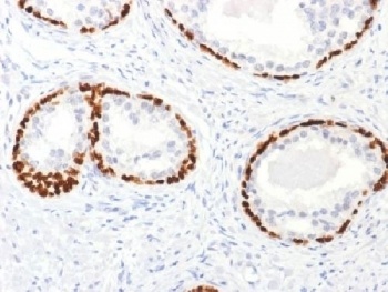 TP63 Antibody
