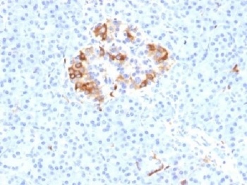 FTL1 Antibody [FTL/1389]