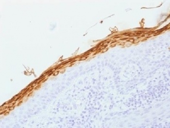 Filaggrin Antibody [FLG/1562]