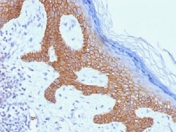 Desmoglein 3 Antibody [DSG3/1535]