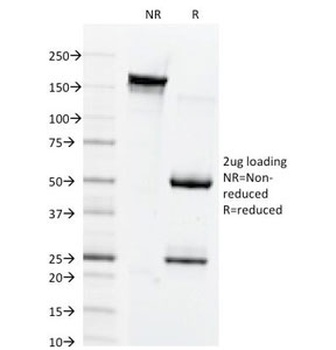 GJB1 Antibody