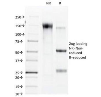 Connexin 32 Antibody [R5.21C]