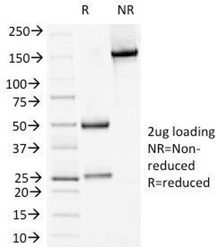 Desmoglein 1 Antibody [18D4]