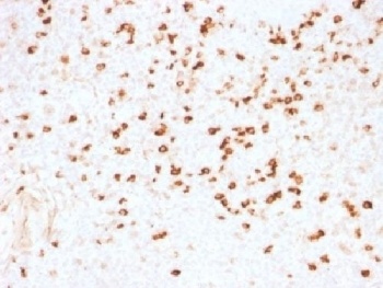 IGLV1-51, cycH Antibody
