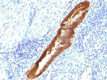 ASRGL1 Antibody [CRASH/1289]