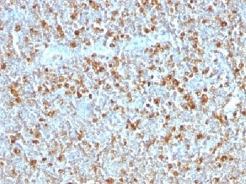 SERPINA1 Antibody