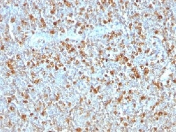 Alpha 1 Antitrypsin Antibody [AAT/1379]