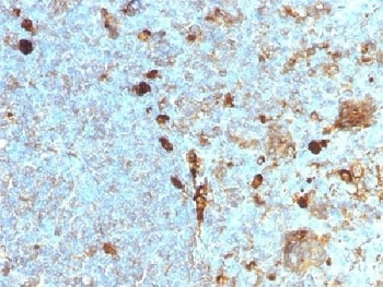 Alpha 1 Antitrypsin Antibody [AAT/1378]