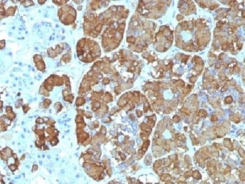 ACTH Antibody [CLIP/1449]