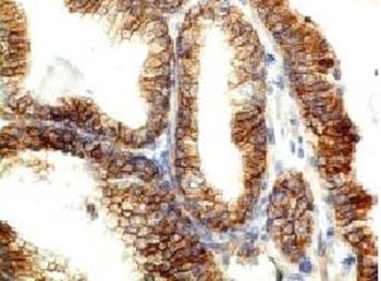 CDH1 Antibody