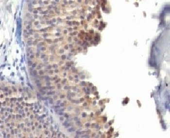 KRT10 Antibody