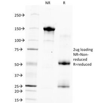 Hepatocyte Specific Antigen Antibody [HSA133]