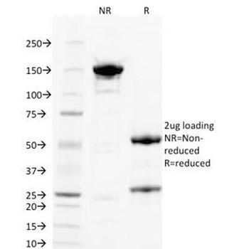 PLGF Antibody [PLGF/93]